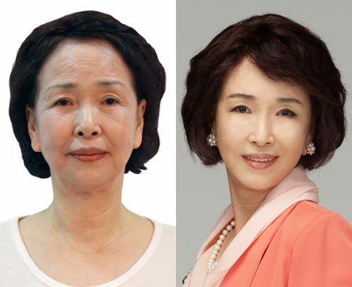 抗衰老有效成分使用效果