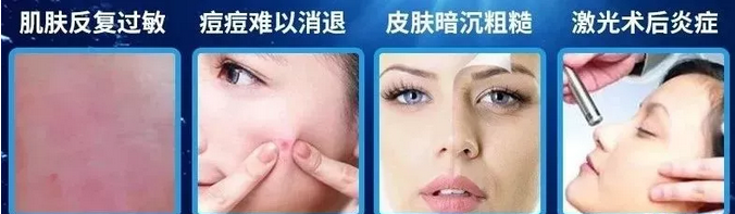 醫用冷敷貼適用的膚質人群